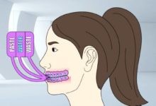 رسم توضيحي لعمل فرشاة الأسنان الآلية التي ابتكرها طبيب من الكويت