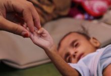 الأمم المتحدة تصف أطفال اليمن