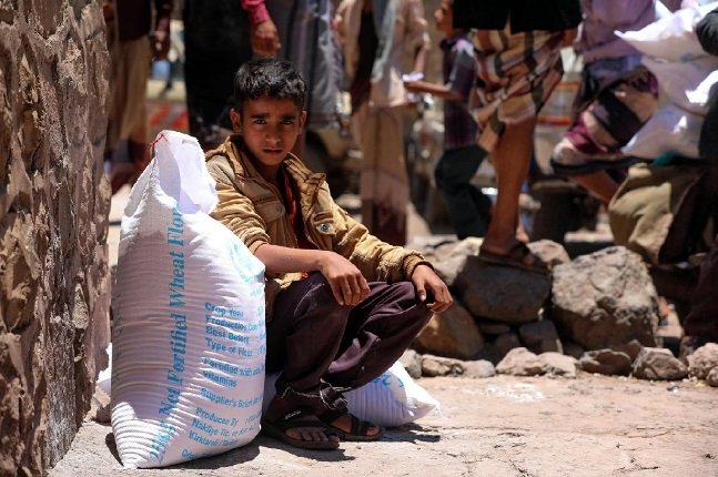 أطفال تحت 5 أعوام في اليمن فريسة سوء التغذية