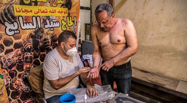 علاج سم النحل